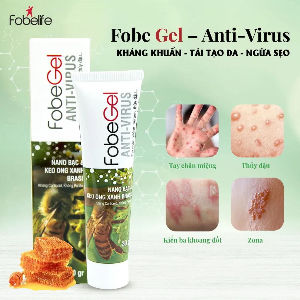 Alternative view of Gel Bôi Tái Tạo Da, Thủy Đậu, Zona Do Virus Gây Nên Fobe Gel Anti Virus 30g - Fobelife