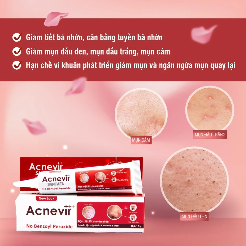 Alternative view of Kem Trị Mụn Đầu Đen, Mụn Cám Acnevir (đỏ) - Santafa