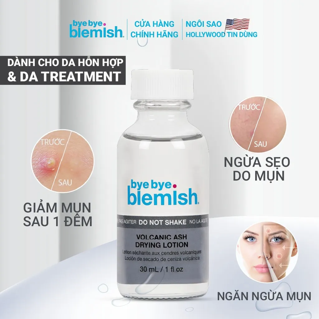 Alternative view of Lotion Chấm Mụn Tro Núi Lửa Giảm Mụn Nhanh Sau 1 Đêm Cho Mụn Đầu Trắng Volcanic Ash Drying Lotion 30ml - Bye Bye Blemish