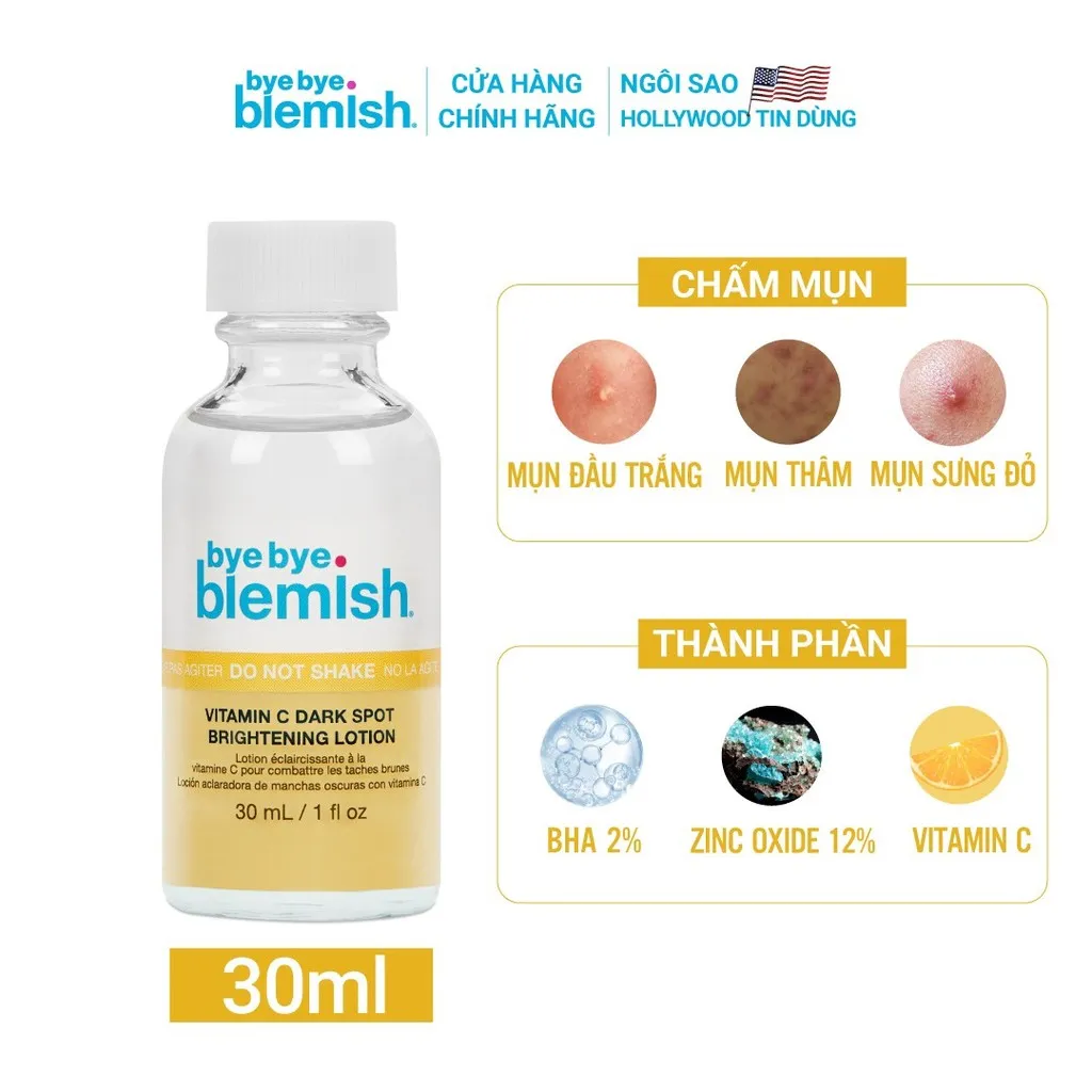 Lotion Chấm Mụn Vitamin C Giảm Mụn Nhanh Sau 1 Đêm Cho Da Mụn Thâm Vitamin C Dark Spot Brightening Lotion 30ml - Bye Bye Blemish