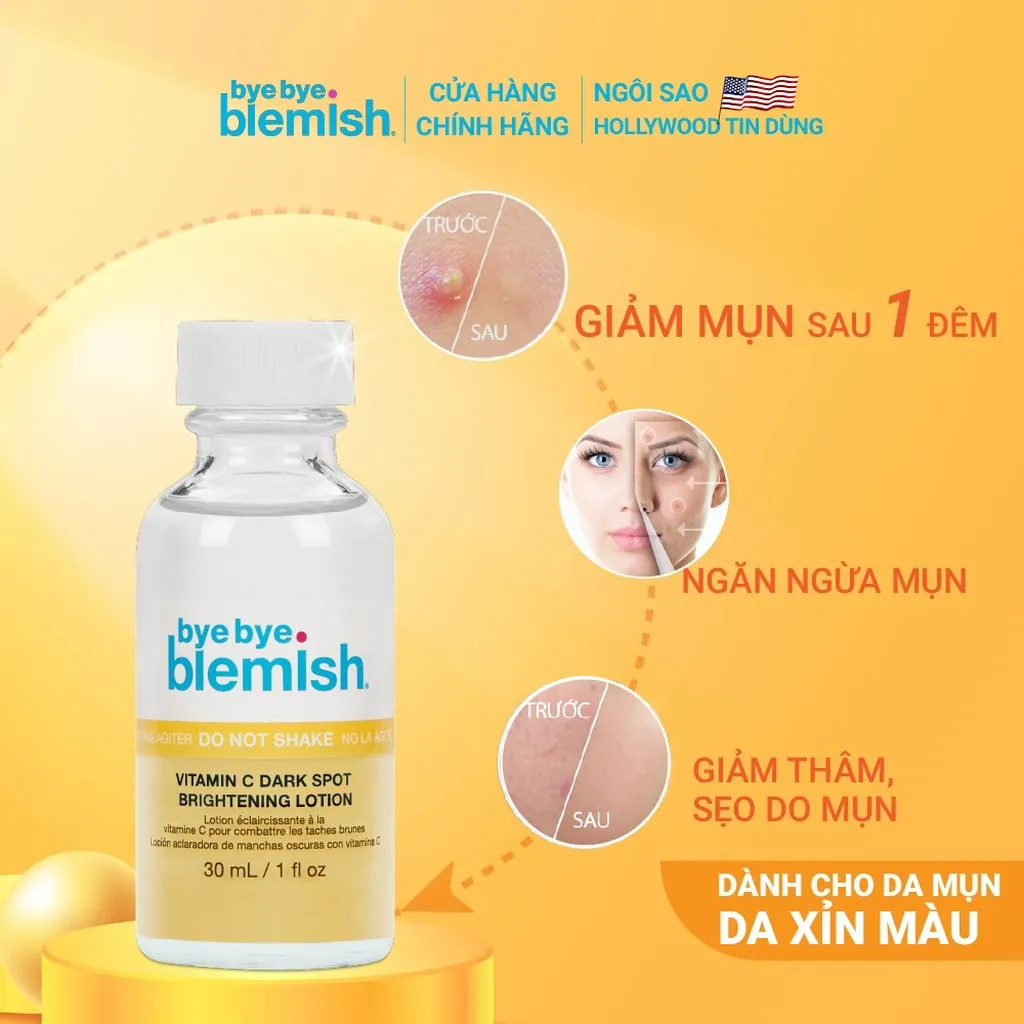 Alternative view of Lotion Chấm Mụn Vitamin C Giảm Mụn Nhanh Sau 1 Đêm Cho Da Mụn Thâm Vitamin C Dark Spot Brightening Lotion 30ml - Bye Bye Blemish