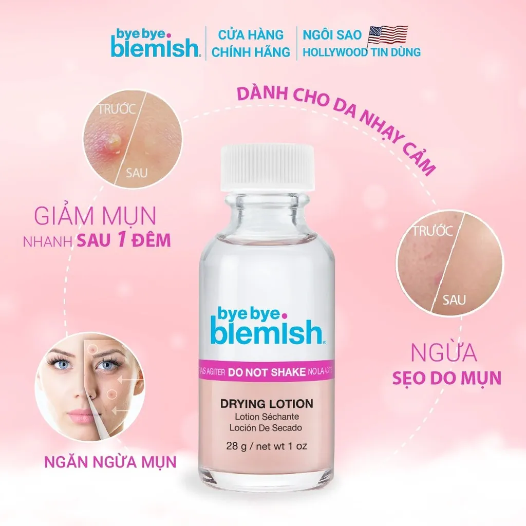 Alternative view of Lotion Chấm Mụn Giảm Mụn Nhanh Sau 1 Đêm Cho Mụn Đầu Trắng Original Drying Lotion 30ml - Bye Bye Blemish
