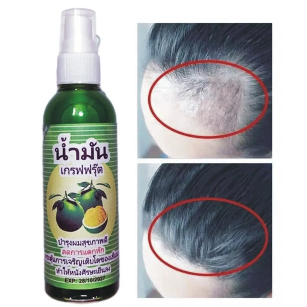 Xịt Mọc Tóc Bưởi Anh Thái Lan Kích Thích Mọc Tóc, Ngăn Ngừa Tóc Gãy Rụng Hiệu Quả 80ml - Gdn