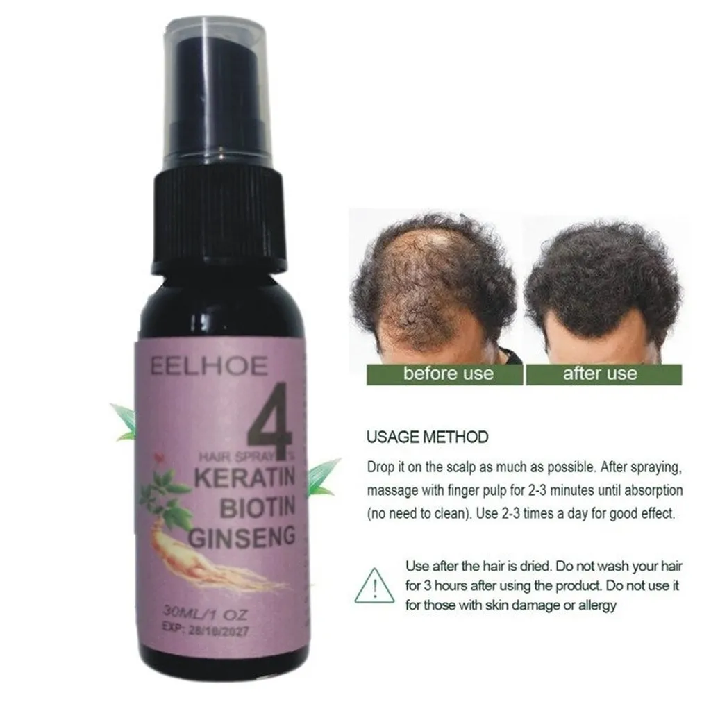 Xịt Mọc Tóc Nhân Sâm Biotin Eelhoe Tím Giám Rụng Tóc, Cải Thiện Hói Đầu, Ngăn Nấm Da Đầu 30ml - Gdn