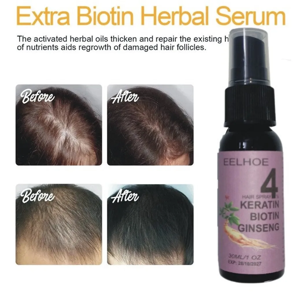 Alternative view of Xịt Mọc Tóc Nhân Sâm Biotin Eelhoe Tím Giám Rụng Tóc, Cải Thiện Hói Đầu, Ngăn Nấm Da Đầu 30ml - Gdn