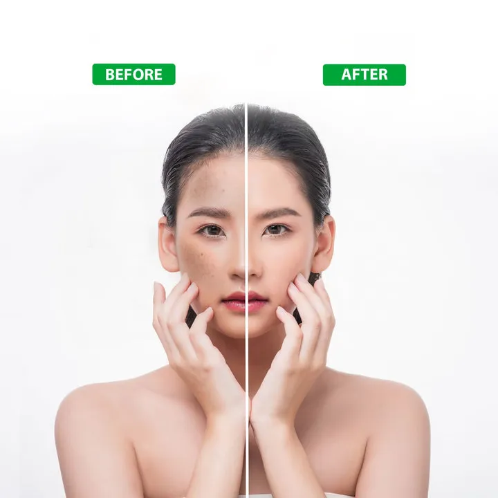 Alternative view of Xịt Cấp Ẩm Sáng Da Từ Thiên Nhiên Acnevir Santafa - Chai 100ml - Santafa