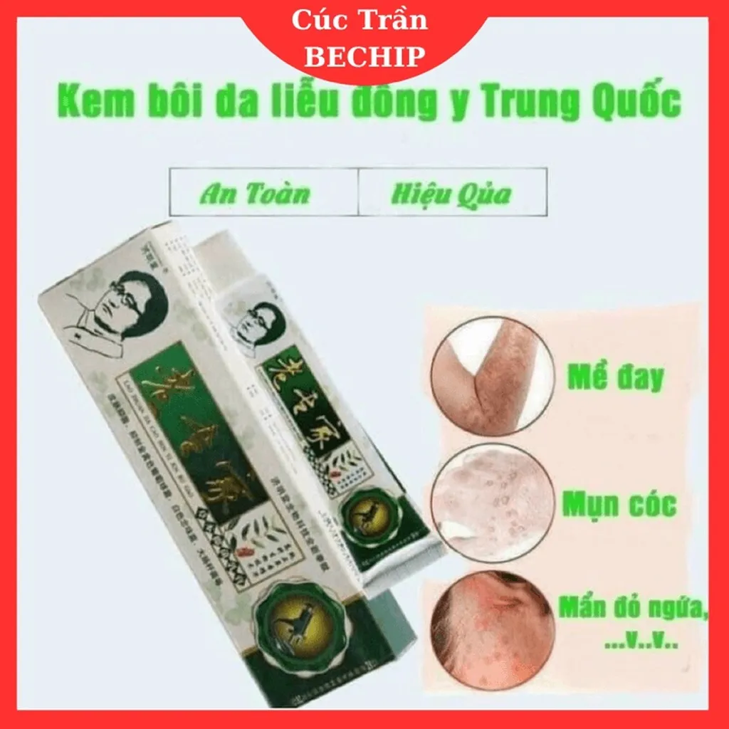Kem Thảo Dược Bôi Ngoài Da: Nứt Nẻ, Nấm Ngứa, Vảy Nến, Á Sừng Cực Kỳ Hiệu Quả - Ctb798